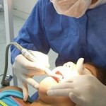 belles dents, érosion dentaire, implant dentaire, guide implant dentaire
